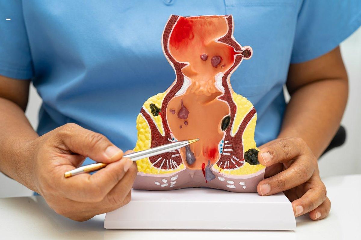 Schéma détaillé de l'anatomie de l'anal sphincter et du plancher pelvien, illustrant les muscles de contrôle anal.