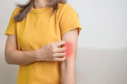 Prévenir les irritations anales après 30 minutes de jeux : astuces efficaces et recommandations